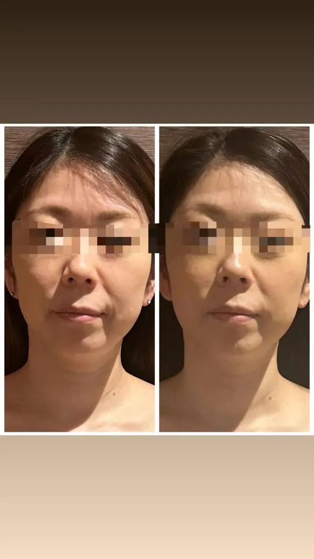 【 老け顔お悩みNo.1 】